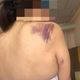 Фото Шердора Абдыкапарова. В Чуйской области супруг избил жену до полусмерти