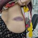 Фото УВД Ошской области . Пострадавшая 64-летняя женщина