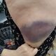 Фото УВД Ошской области. Пострадавшая 64-летняя женщина